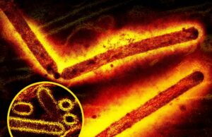 Pesquisadores de todo o país alertam sobre o aumento da complicação fatal da gripe que afeta crianças pequenas Pesquisadores de todo o país alertam sobre o aumento da complicação fatal da gripe que afeta crianças pequenas