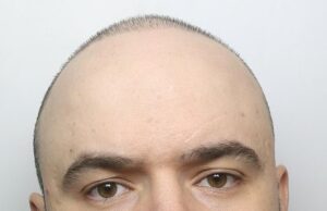 Revelado: as mensagens incrochat que prenderam um grupo de culinária por 65 anos quando inundaram as ruas da Grã -Bretanha com £ 81 milhões ‘Rolex’ Drogas rotuladas As mensagens enviadas pelo líder de gangue Redon Bushi (foto), 32, de Brentford, oeste de Londres, mostraram seus planos de entregar pelo menos 832 kg de cocaína, com um valor de rua de até £ 81.640.000, em Londres e o restante do Reino Unido