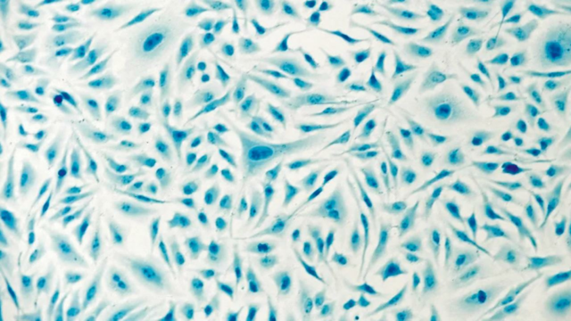 Serina 3-D impressa dentro de uma célula

