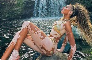 Winni proibiu fotos sexuais que experimentam sua 31ª Llania! 0717-winni-hardo-hardo-hot-1-1