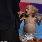 Little Sham Kadih, que sofre de desnutrição, pode ser visto chorando ao cuidar do Hospital Nasser no sábado
