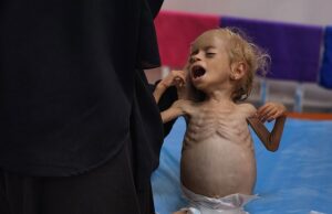 As imagens da Harvating mostram um garoto palestino esquelético, dois, grita que outros 11 morrem de desnutrição em Gaza, reivindicações do Ministério da Saúde do Hamas, Little Sham Kadih, que sofre de desnutrição, pode ser visto chorando ao cuidar do Hospital Nasser no sábado