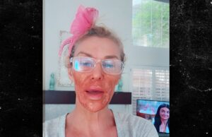 Branan eu gosto do rosto com Nair enquanto luta contra um parasita de glanville Brandy-Glalanvil-Kal-08-04-2025