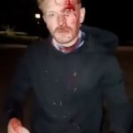 Um homem sofreu um corte grave e sangue escorrendo pelo rosto depois que ele foi atacado com 'uma garrafa de vidro contendo um pano iluminado' depois que ele colocou bandeiras da Inglaterra em Stevenage, Hertfordshire