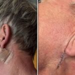 Gordon Ramsay Skin Cancer Instagram 3