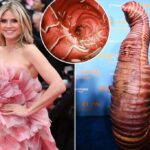 Heidi Klum realiza um "worm e parasita" - Doc adverte como ele pode fazer mais mal do que bem