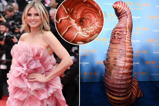 Heidi Klum realiza um "worm e parasita" - Doc adverte como ele pode fazer mais mal do que bem

