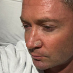 Michael Clarke, capitão anterior da Austrália, identificado com células de câncer de pele