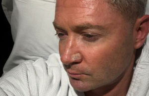 Michael Clarke, capitão anterior da Austrália, identificado com células de câncer de pele Michael Clarke, capitão anterior da Austrália, identificado com células de câncer de pele