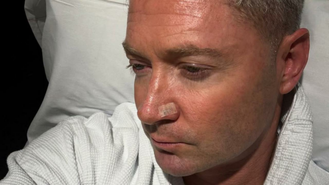 Michael Clarke, capitão anterior da Austrália, identificado com células de câncer de pele 

