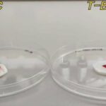 Os pesquisadores desenvolvem juntas bacterianas à base de celulose para queimaduras avançadas