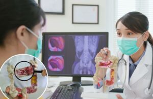 O hábito principal aumenta os indicadores de sobrevivência do câncer colorretal – porque os documentos veem o “enorme crescimento” dos jovens com esta doença O hábito principal aumenta os indicadores de sobrevivência do câncer colorretal - porque os documentos veem o "enorme crescimento" dos jovens com esta doença