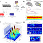 Os neurocientistas ajudam a identificar um biomarcador para a progressão da doença de Alzheimer