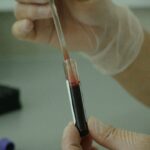 amostra de sangue