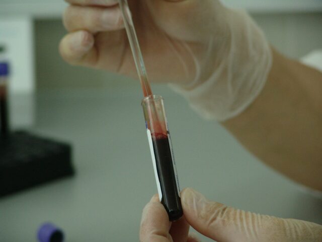 amostra de sangue