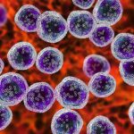 Os modelos de IA podem ajudar a prever a mortalidade hospitalar em pacientes com UTI com linfoma