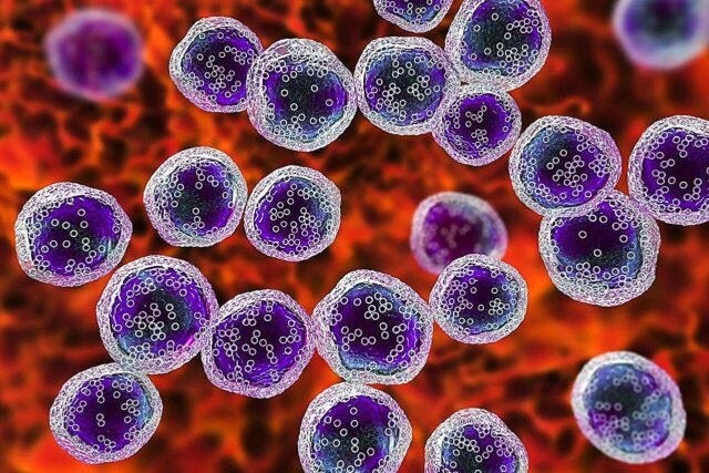 Os modelos de IA podem ajudar a prever a mortalidade hospitalar em pacientes com UTI com linfoma