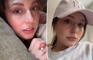 ‘Preocupado’ Katie Thurston danifica os rasgos quando ela começa a sensação doente no meio da fase 4 Bust Câncer Células Fight 'Preocupado' Katie Thurston danifica os rasgos quando ela começa a sensação doente no meio da fase 4 Bust Câncer Células Fight