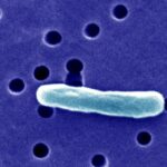 Vinte e um pacientes na Flórida ficam doentes - alguns com E. coli - depois de consumir leite cru, de acordo com o aviso do Departamento de Saúde da Flórida.