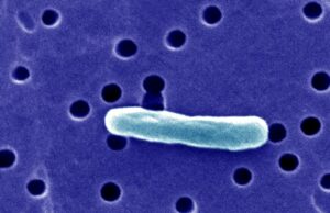 Quase doze pessoas em nosso doente bebendo leite cru do mesmo país Vinte e um pacientes na Flórida ficam doentes - alguns com E. coli - depois de consumir leite cru, de acordo com o aviso do Departamento de Saúde da Flórida.