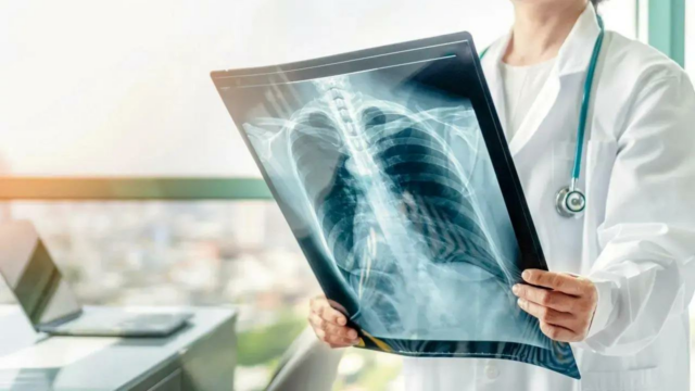 14 Computador de índios com 45 anos ou mais pode ter doenças pulmonares obstrutivas: estudo de pesquisa 

