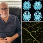 A reunião de RH do homem australiano leva a um diagnóstico de saúde impressionante