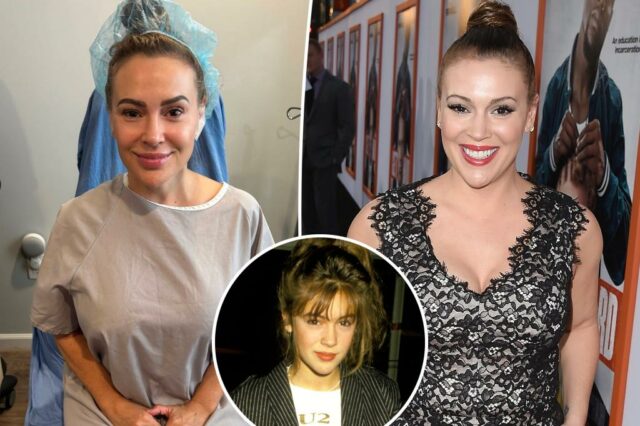Alyssa Milano remove seus implantes mamários: 'Deixando de lado o corpo que foi sexualizado' e 'abusado'

