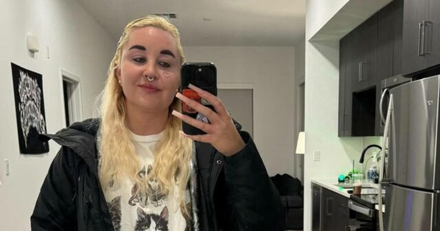 Amanda Bynes marcha com fortes cabelos em dois tons após a obtenção de enchimento labial 

