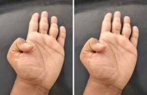 Este exame de polegar de dois segundos pode mostrar se você for ameaçar por uma questão cardíaca-abaixo é como fazê-lo na casa Pessoa em uma camiseta branca fazendo um exame de auto-brega com as mãos posicionadas no peito e no abdômen