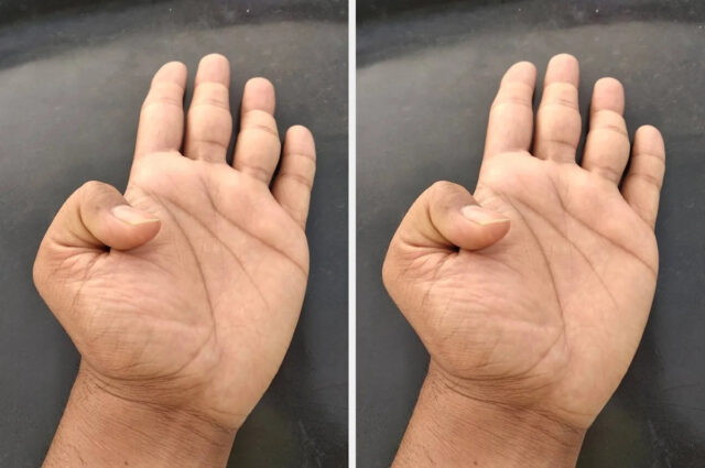 Pessoa em uma camiseta branca fazendo um exame de auto-brega com as mãos posicionadas no peito e no abdômen
