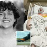 Estudante do Texas College, 19 anos, sofre queimaduras catastróficas e de mudança de vida depois de serem atingidas pelo suposto motorista bêbado