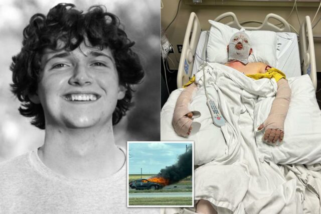 Estudante do Texas College, 19 anos, sofre queimaduras catastróficas e de mudança de vida depois de serem atingidas pelo suposto motorista bêbado

