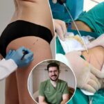 Eu sou um cirurgião plástico - por que nunca realizaria um 'acordado bbl', eu ouvi histórias de horror absoluto
