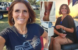 Mamãe quase perde a vida e a perna depois de contrair bactérias que comem carne durante a Florida Swim: ‘A dor é inacreditável’ Mamãe quase perde a vida e a perna depois de contrair bactérias que comem carne durante a Florida Swim: 'A dor é inacreditável'