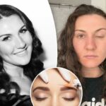 Não consigo abrir meu olho depois de um botox mal estragado - preciso gravar minha tampa para dirigir