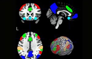 O estudo de pesquisa leva meios para o TMS personalizado para ajudar os fumantes de cigarros A pesquisa abre caminho para o TMS personalizado para ajudar os fumantes