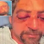 O marido de Vermont quase permanentemente cego após a raiva da estrada, maníaca, grudou os olhos durante o ataque brutal