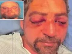 O marido de Vermont quase permanentemente cego após a raiva da estrada, maníaca, grudou os olhos durante o ataque brutal O marido de Vermont quase permanentemente cego após a raiva da estrada, maníaca, grudou os olhos durante o ataque brutal