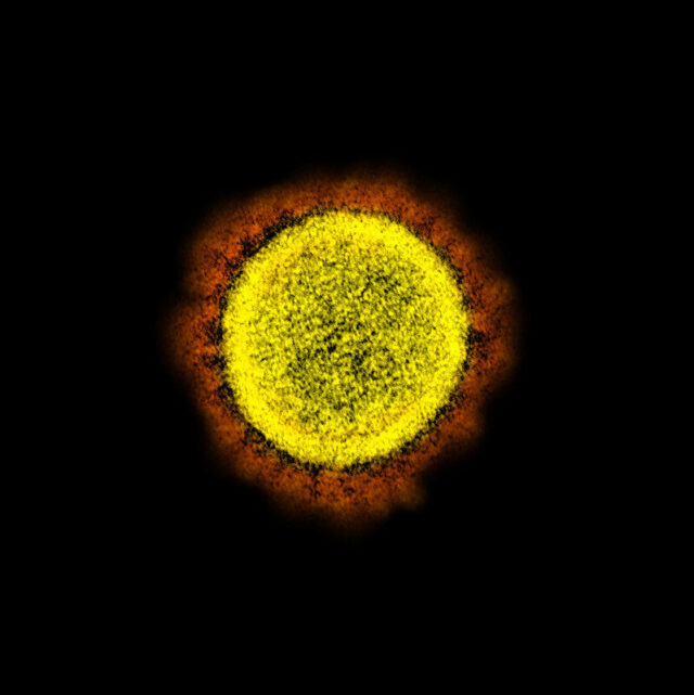SARS-NO-2, RENID-19