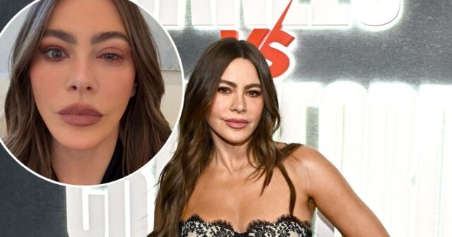 Sofia Vergara perde o Emmys como resultado da reação alérgica dos olhos, precisava ir para a sala de emergência 

