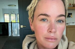 Teddi Mellencamp revela a progressão do desenvolvimento capilar com as células cancerígenas Atualização de luta Teddi Mellencamp compartilha uma atualização de cabelo emocional em meio à batalha do câncer