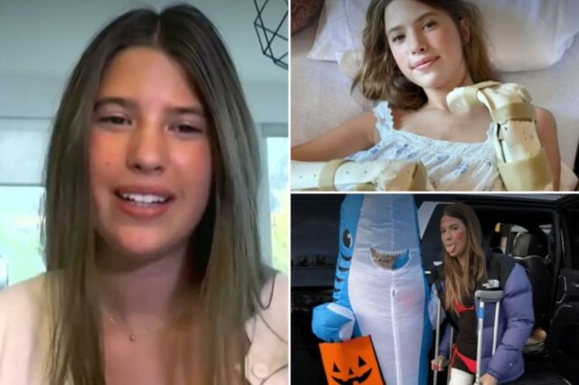 Teen lembra o momento dois tubarões arrancados da perna um ano após o ataque brutal

