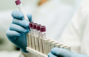 3 menores entre vários culpados de drogas receberam restrição de 3 anos para admissão muito precoce 3 menores entre vários culpados de drogas receberam restrição de 3 anos para admissão muito precoce