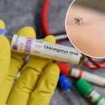 Um residente de Nova York testou positivo para o vírus chikungunya transmitido por mosquitos – marcando o primeiro caso transmitido localmente nos EUA em seis anos, disseram autoridades na terça-feira.