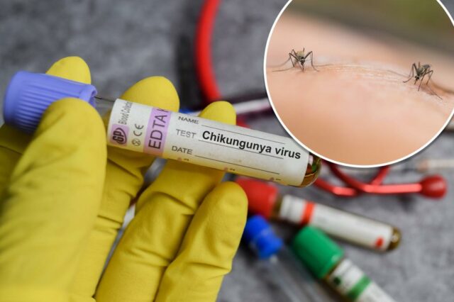 Um residente de Nova York testou positivo para o vírus chikungunya transmitido por mosquitos – marcando o primeiro caso transmitido localmente nos EUA em seis anos, disseram autoridades na terça-feira.