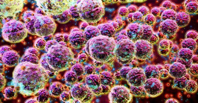 Bactérias pouco conhecidas, causando taxas crescentes de infecções potencialmente mortais

