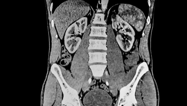 Cientistas levantam sinais de alerta sobre a ameaça generalizada à Yahoo news home