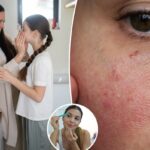 Crianças e pré-adolescentes estão desenvolvendo problemas para o resto da vida por causa de suas rotinas de cuidados com a pele, alerta derm – o culpado número 1