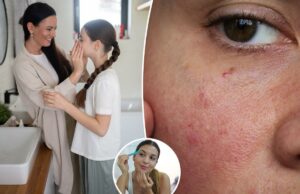 Crianças e pré-adolescentes estão desenvolvendo problemas para o resto da vida por causa de suas rotinas de cuidados com a pele, alerta derm – o culpado número 1 Crianças e pré-adolescentes estão desenvolvendo problemas para o resto da vida por causa de suas rotinas de cuidados com a pele, alerta derm – o culpado número 1