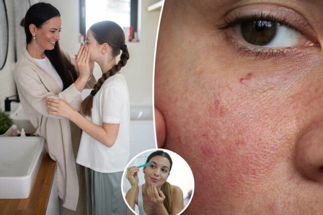 Crianças e pré-adolescentes estão desenvolvendo problemas para o resto da Crianças e pré-adolescentes estão desenvolvendo problemas para o resto da vida por causa de suas rotinas de cuidados com a pele, alerta derm – o culpado número 1